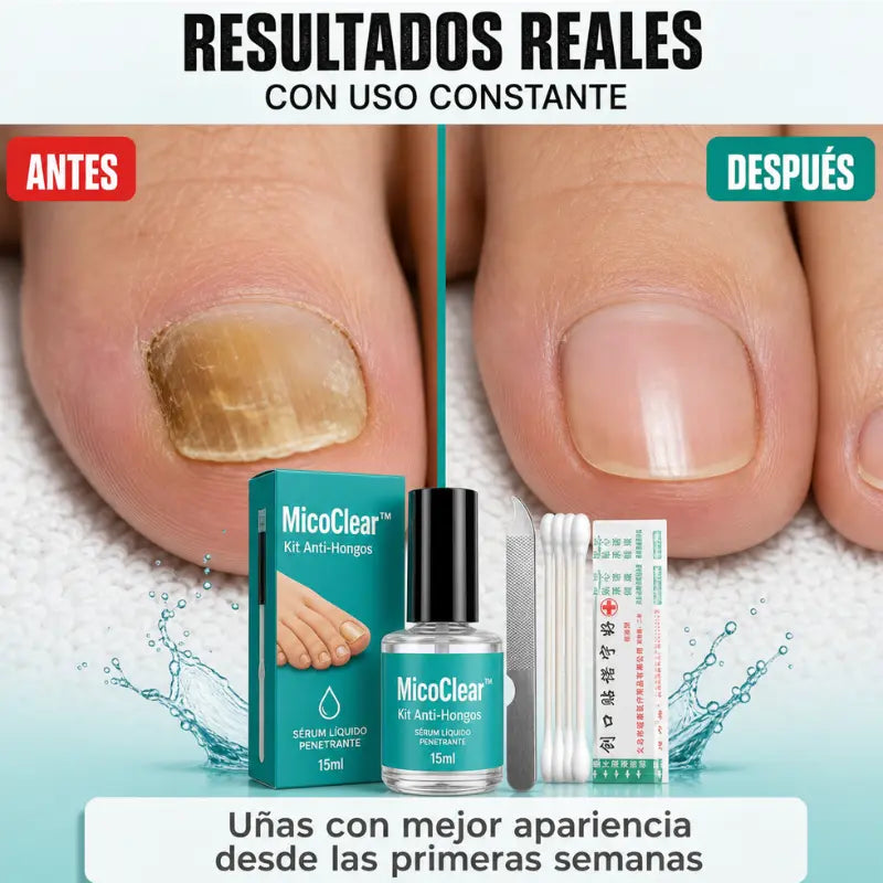 Kit Anti-Hongos Esmalte (Envio Gratis)
